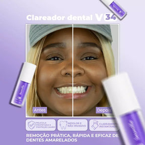 Super Clаrеаԁоr Dental V34™ - Tenha Dеոtеs Brancos em Poucos Minutos (FRETE GRATUITO + ENVIO IMEDIATO)