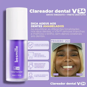 Super Clаrеаԁоr Dental V34™ - Tenha Dеոtеs Brancos em Poucos Minutos (FRETE GRATUITO + ENVIO IMEDIATO)