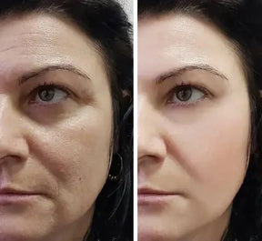 Creme Mágico FaceSlift® - Esconde 100% Imperfeições e Remove Manchas e Rugas