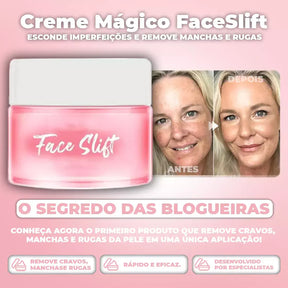 Creme Mágico FaceSlift® - Esconde 100% Imperfeições e Remove Manchas e Rugas